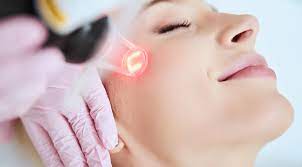 Five Things To Know About Laser Acne Treatment For Beautiful Skin